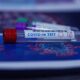 PCR falso positivo