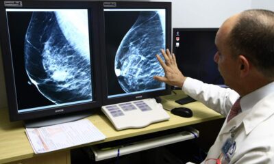 mamografias