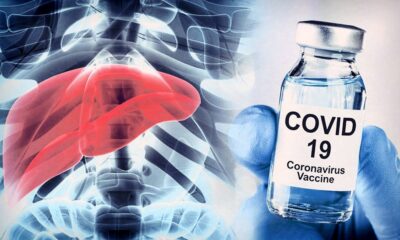 hepatitis