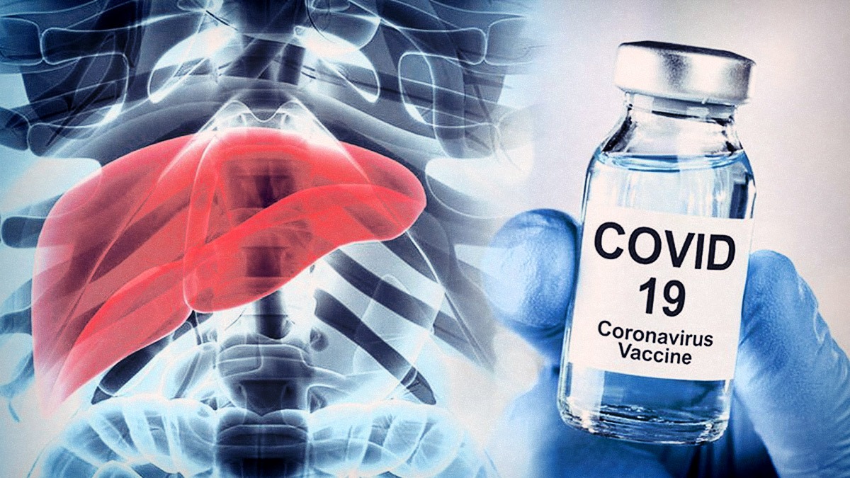 hepatitis